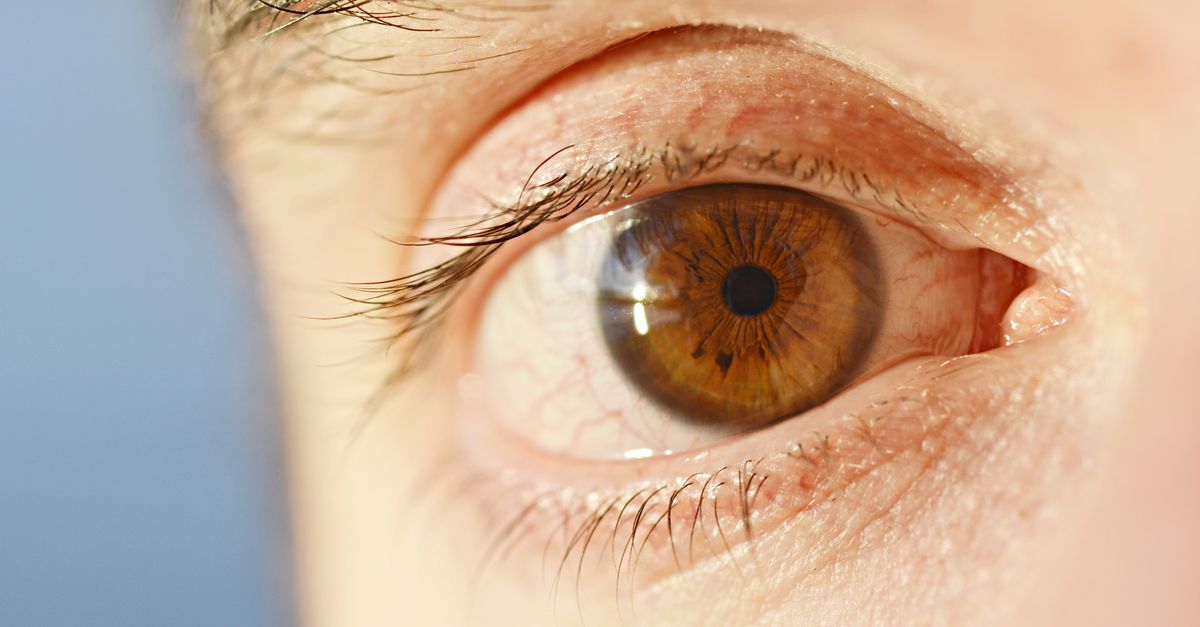 Detailed close-up of a human brown eye with visible iris and eyelashes.